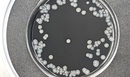 lab plate of positive legionella test (colors are black gel and white bacteria)
