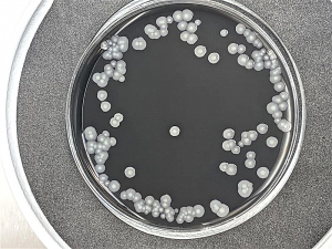 lab plate of positive legionella test (colors are black gel and white bacteria)